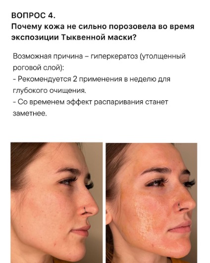 Изображение выглядит как Человеческое лицо, кожа, текст, снимок экранаКонтент, сгенерированный ИИ, может содержать ошибки.